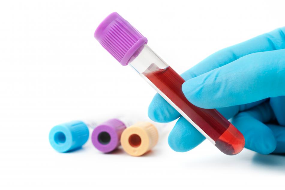 Где сдать общий анализ крови ребенку в воронеже thumbnail