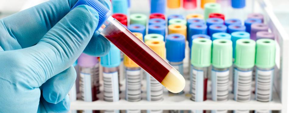 Сдать биохимический анализ крови ребенку